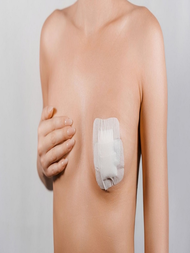 Best Breast Reduction in Altrincham